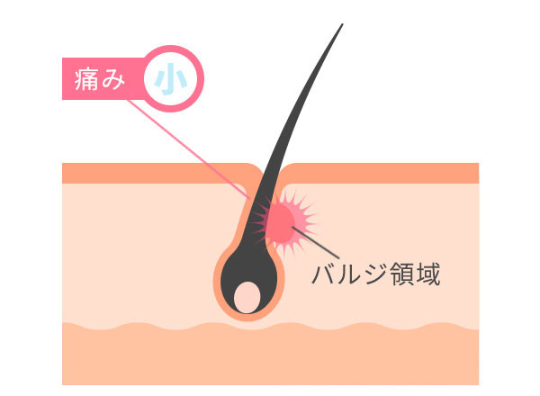 蓄熱式の図説