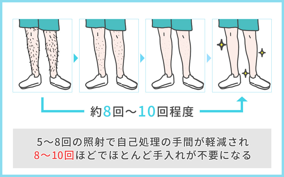 医療脱毛の回数の目安の図説