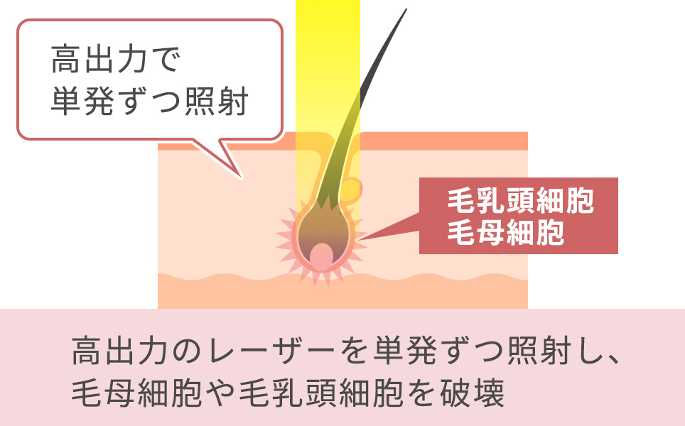 熱破壊式の説明図説