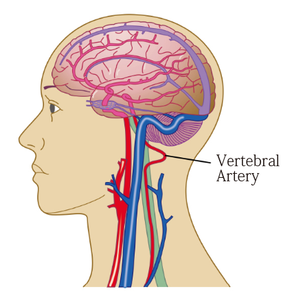 Vertebral Artery