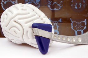 Figure of human brain with neurologic hammer on a background of spiral computer tomography (SCT) or magnetic resonance tomography (MRT) picture close up. Idea for diagnostics in neurology