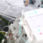 Hemodialysis machine in the ward