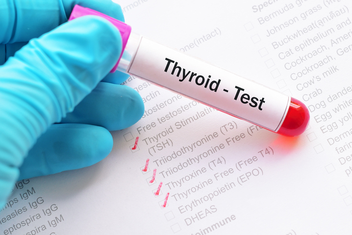 Thyroid hormone test