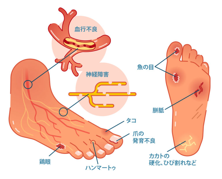 nerve endings in feet