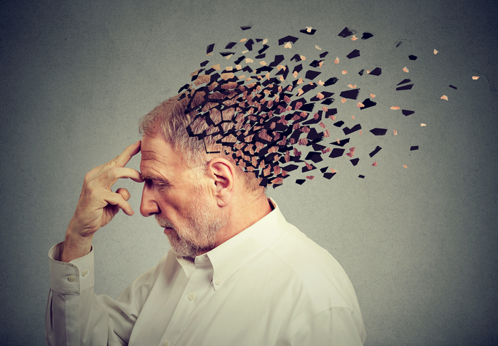 Memory loss due to dementia. Senior man losing parts of head as symbol of decreased mind function.