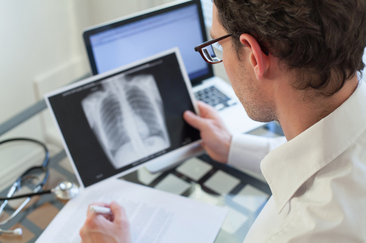 doctor looking at x-ray of lungs and writing diagnosis