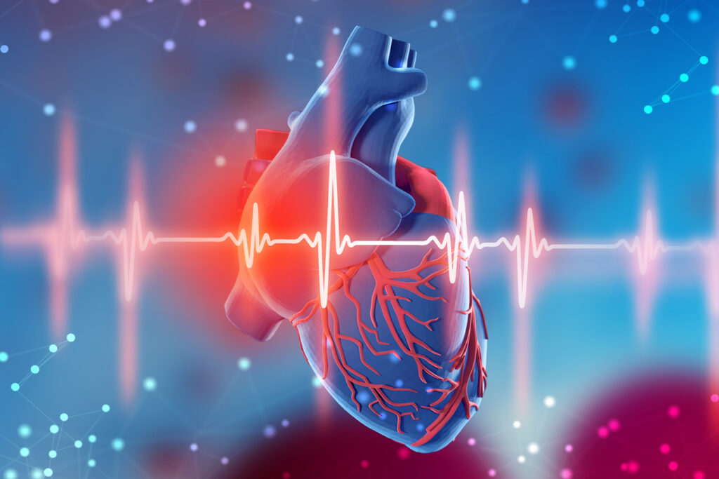 心筋梗塞予防のために「心臓ドック」を専門医がお薦めする理由