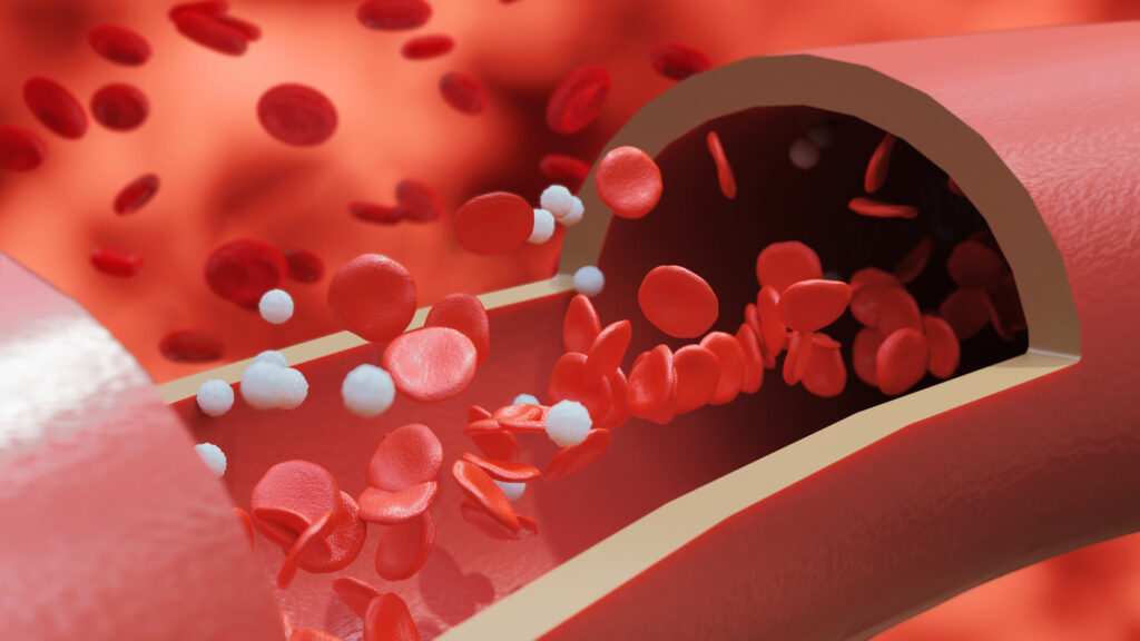 血液サラサラ、抗血小板療法の効果・注意点について専門医が解説